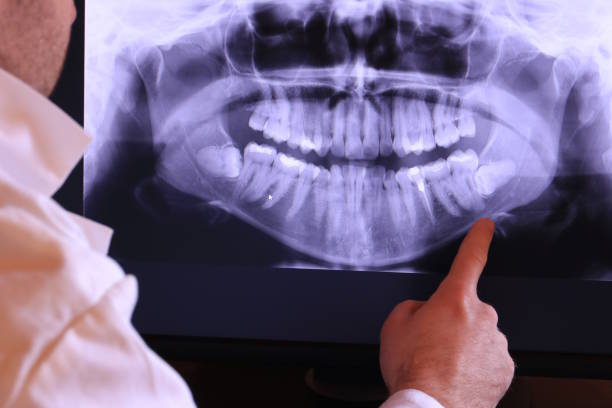 Best Emergency Denture Repair in Slippery Rock University, PA