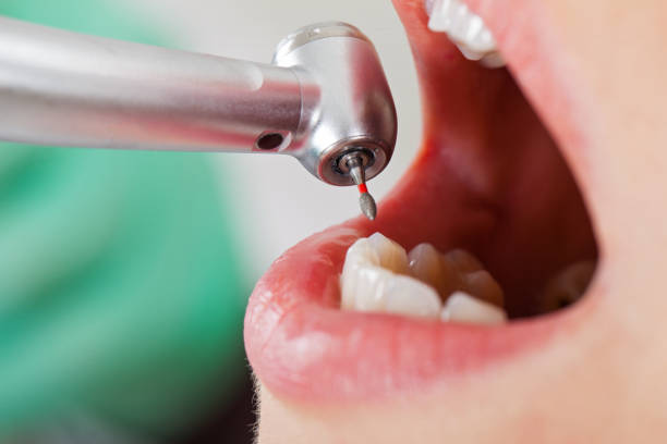 Best Emergency Treatment for Oral Infections in Slippery Rock University, PA